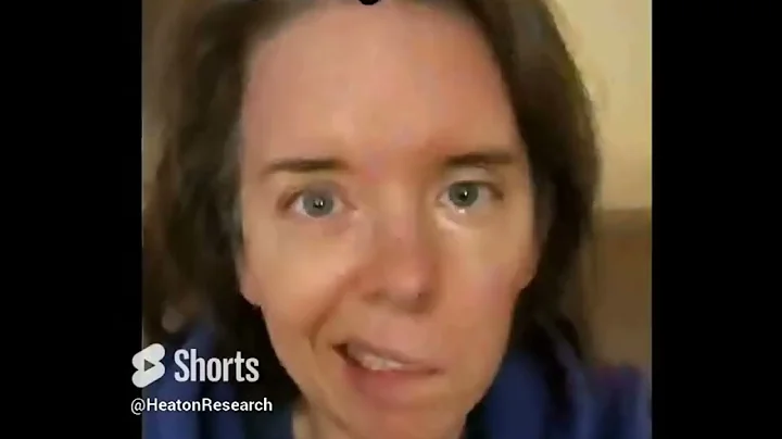 Recovery After Facial Reanimation Surgery: A Time Lapse Video