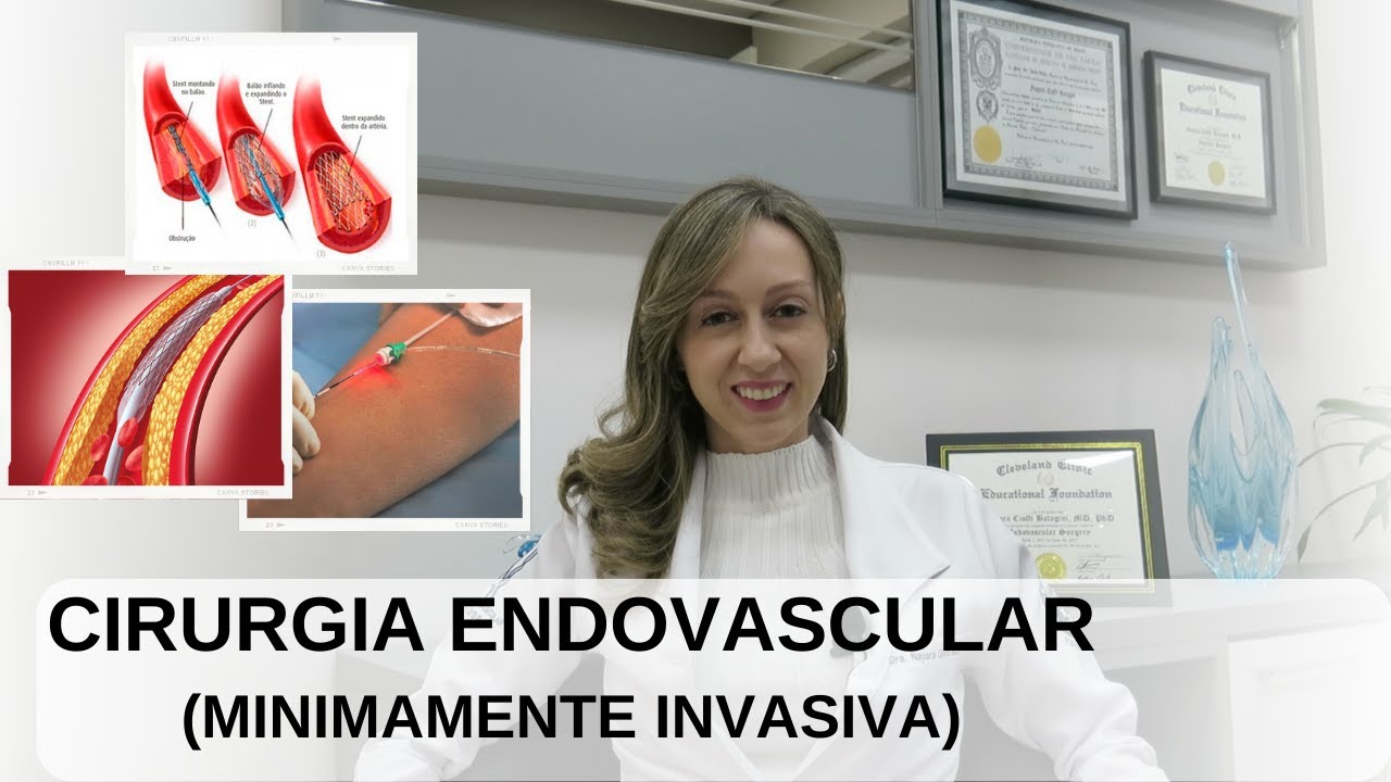 VIDEOGIN  Cirurgia Minimamente Invasiva