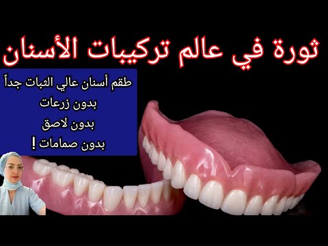 الآن طقم أسنان متحرك عالي الثبات جدا جدا و إقتصادي بدون زرعات وبدون لاصق  