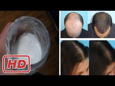 [Healthy Life]How to Make Baking Soda Shampoo For Hair Growth | Natural Home Remedy