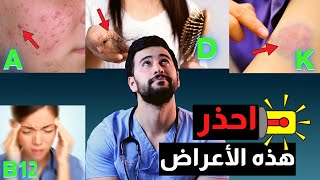 رسائل مهمة من جسمك تخبرك أنك تعاني من نقص فيتامينات شديد! الجزء الثاني 2