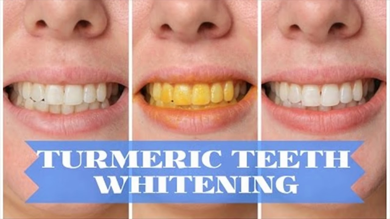 Turmeric Helps To Treat Teeth Pain And Infections How To Use YouTube