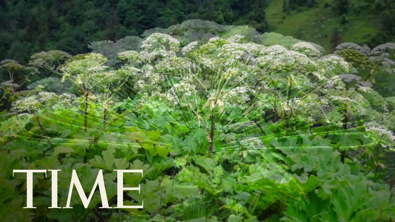 Invasive Weed Causes Teen To Suffer Third-Degree Burns: Safely Identify And Remove Giant Hogweed