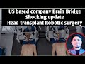Head transplant news | Brain Bridge | Robotic surgery |  #usa #india #viral #trending #upsc #ssc