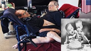 Senior citizen conjoined twins to set record as longest lived