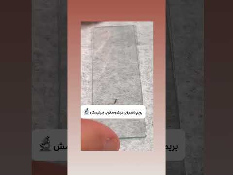 شپش سر از نزدیک