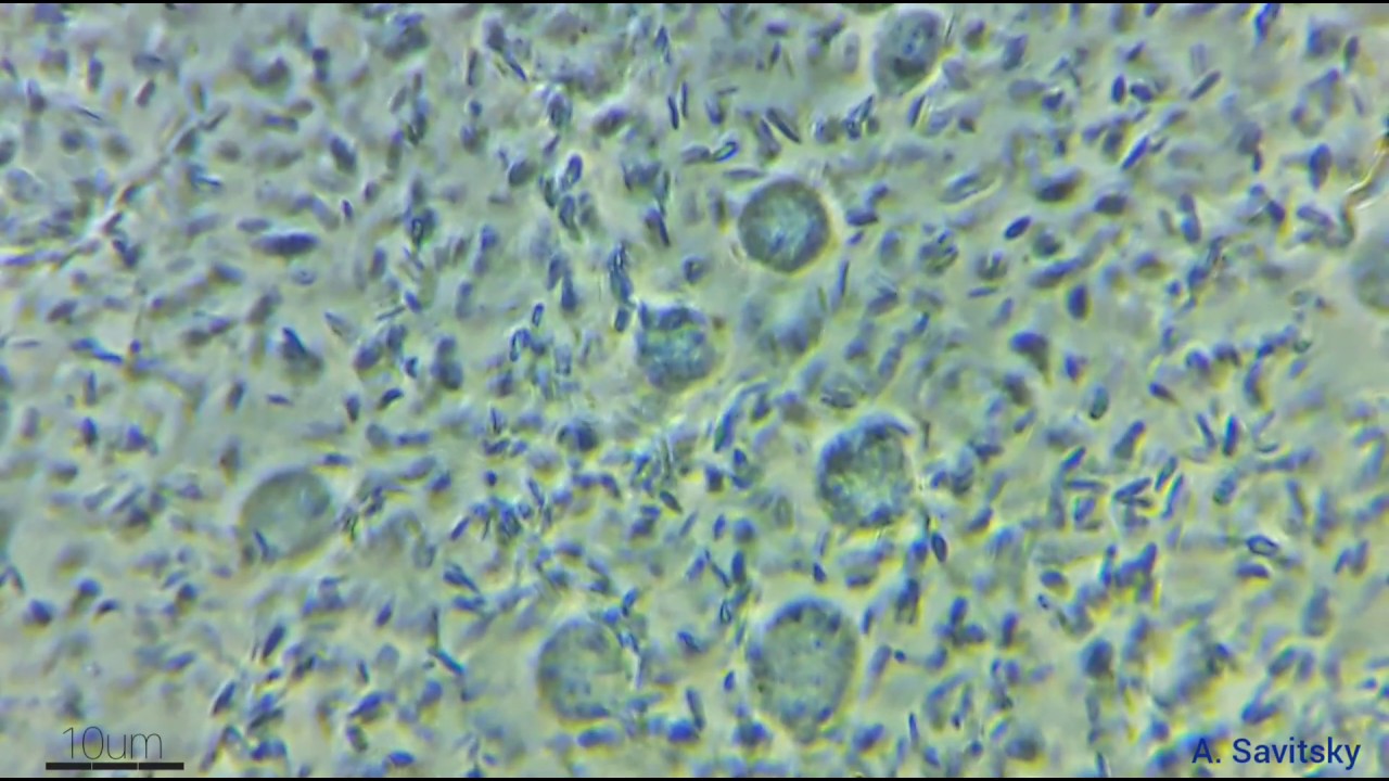 Гемолимфа божьей коровки \\ Hemolymph in ladybug. YouTube