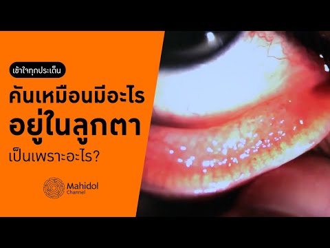 ภูมิแพ้ที่เยื่อบุตา รักษาอย่างไร? [หาหมอ by Mahidol Channel]