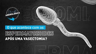 Minuto Andrológico O Que Acontece Com Os Espermatozoides Após Uma Vasectomia?
