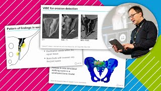 Advanced imaging of spondyloarthropathies*: What is new? // *aka Spondyloarthritis