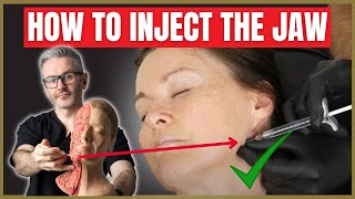 Jawline Injection Techniques | Injecting the Jaw Safely