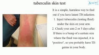 tuberculin skin test (English) - Medical terminology for medical students -