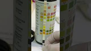 Urine test,is mai Sugar.SBR.Protein.and epithelial cells ko show hongi