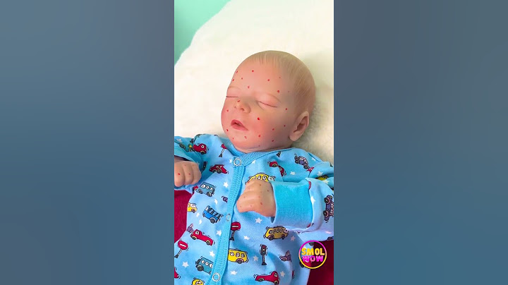 Sprytne rodzicielskie sztuczki, które pozwolą trzymać komary z daleka! 🦟👶 #rodzicielstwo #sztuczki #porady