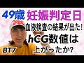 49歳の妊娠判定！(hCG数値はいかに？)