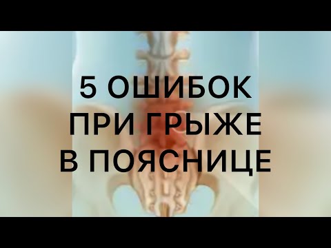 Что нельзя делать при грыже в пояснице