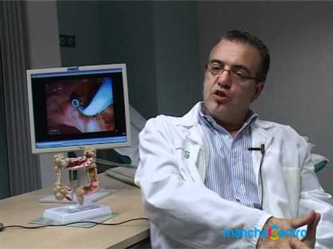 Vídeo: Enfermedad De La úlcera Duodenal: Síntomas Y Tratamiento