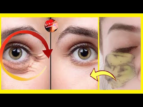 By Adding This, Banana Peel Becomes an Under Eye Wrinkle Eraser! Remove Under Eye Dark Circles