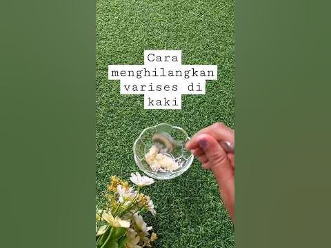 Cara alami menghilangkan varises di kaki #tipsalami #caraalami #