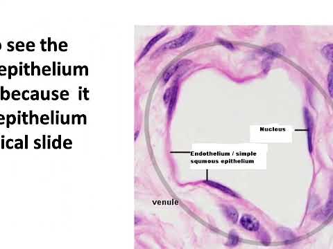 Simple squamous epithelium: endothelium, endocardium, mesothelium