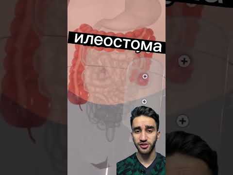 что это за мешочек?
