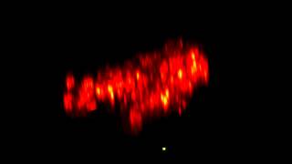 Celebrity Mesothelioma tube formation Appendix B.1 Profile