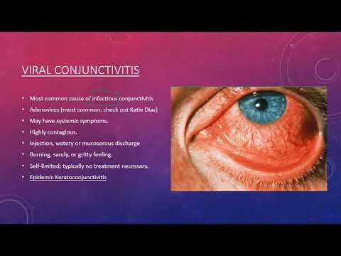 Video: Hur Länge Varar Pink Eye? Viral Kontra Bakteriell Rosa öga