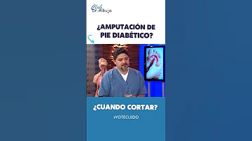 ¿Por qué te cortan los dedos de los pies cuando tienes diabetes?