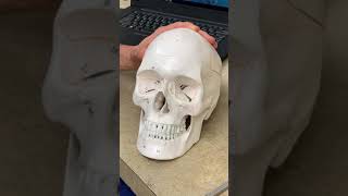 Osteotomy and Rhinoplasty - Daniel Becker