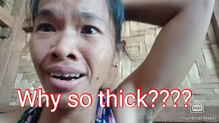 Where Did I Get This I Hairy Armpit I Roselyn Wagas I Philippines I Maramag Bukidnon
