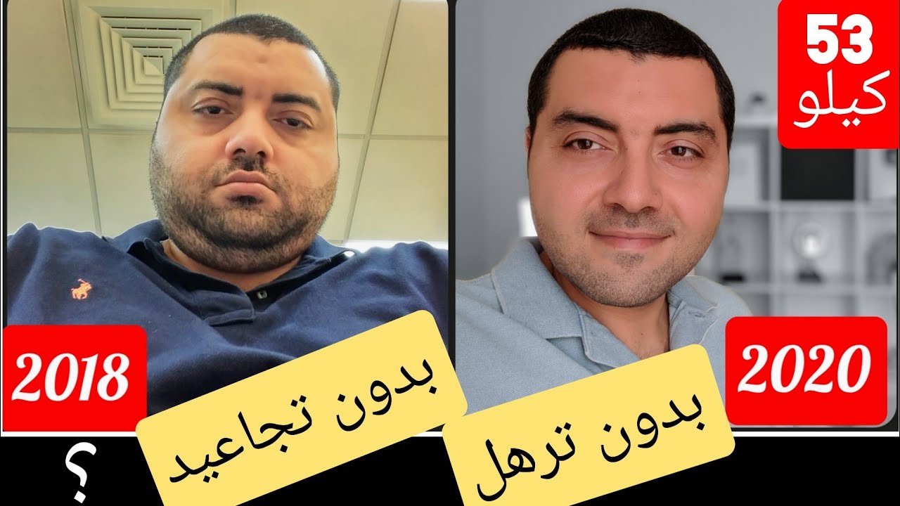 خسرت 50 كيلو ! كيف حافظت على وجهي بدون ترهلات ؟ اسباب نحافه الوجه بعد فقدان الوزن ؟
