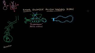 Amfizem Nedir? Fen Bilimleri Sağlık Ve Tıp