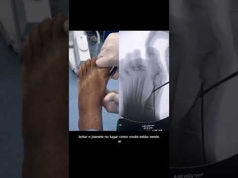Como consigo operar