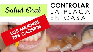 como CONTROLAR el SARRO  ‍♀  dental en CASA si no puedes ir al ODONTÓLOGO ‍⚕