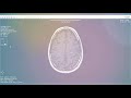 Adjusting time parameters post scan with SyMRI