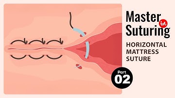 Horizontal Mattress Suture - Learn Suturing Technique | Part 2