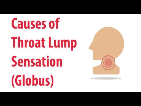 Kænguru kølig hvidløg Causes of Throat Lump Sensation (Globus) - YouTube