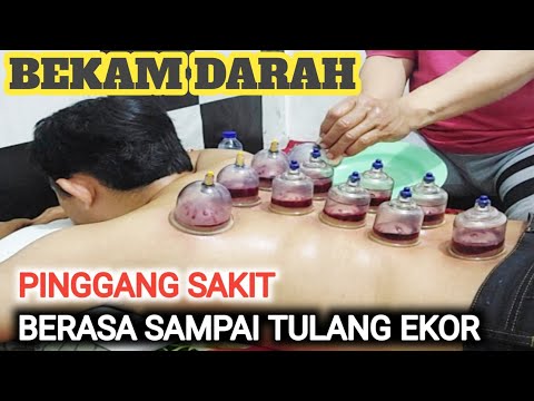 PINGGANG SAKIT BERASA KE TULANG EKOR. @PIJAT & BEKAM TERDEKAT SURABAYA