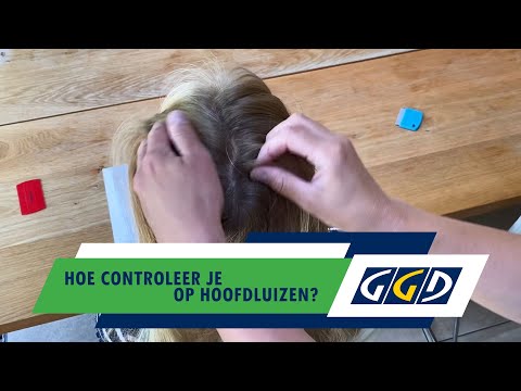 Video: Hoe te controleren op luizen (met afbeeldingen)