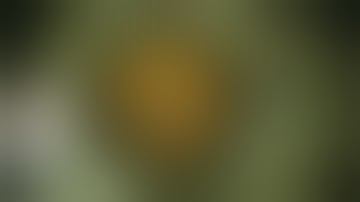 Phacoemulsification &  Endocapsular Carousel Technique