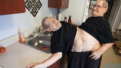 Ronnie and Donnie Galyon. World's longest survivin...