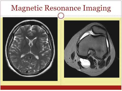 MRI and MRA scans - What is the difference?