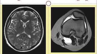 MRI and MRA scans -  What is the difference?