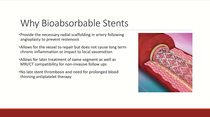 ME4340 Bio Stents