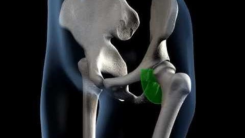 Hip Joint Range of Movement - 3D Medical Animation || ABP ©