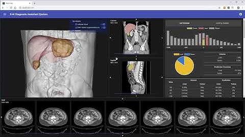 Web-based Liver Cancer Diagnosis | Imagoworks Technology