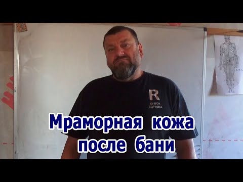 Олег Рябиков - Лекарь "Мраморная кожа после бани"