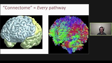 OHBM2020: Network Neuroscience 2