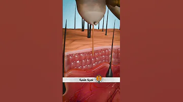 كيف يعيش القمل في رأسك 