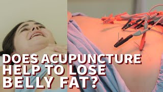 [Medilog] Korean traditional medicine for weight loss? Does acupuncture help to lose belly fat?